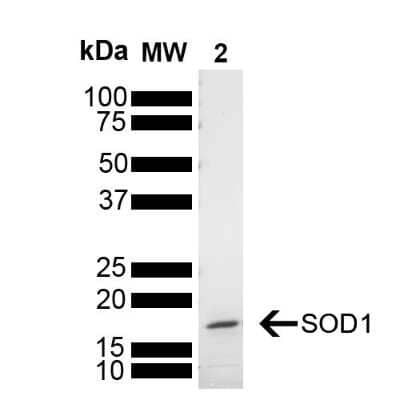 SDS-Page: Recombinant Human SOD1/Cu-Zn SOD Active, Monomer Protein [NBP3-14782] - SDS-PAGE of human SOD1 monomer protein (NBP3-14782). Load: 2 ug